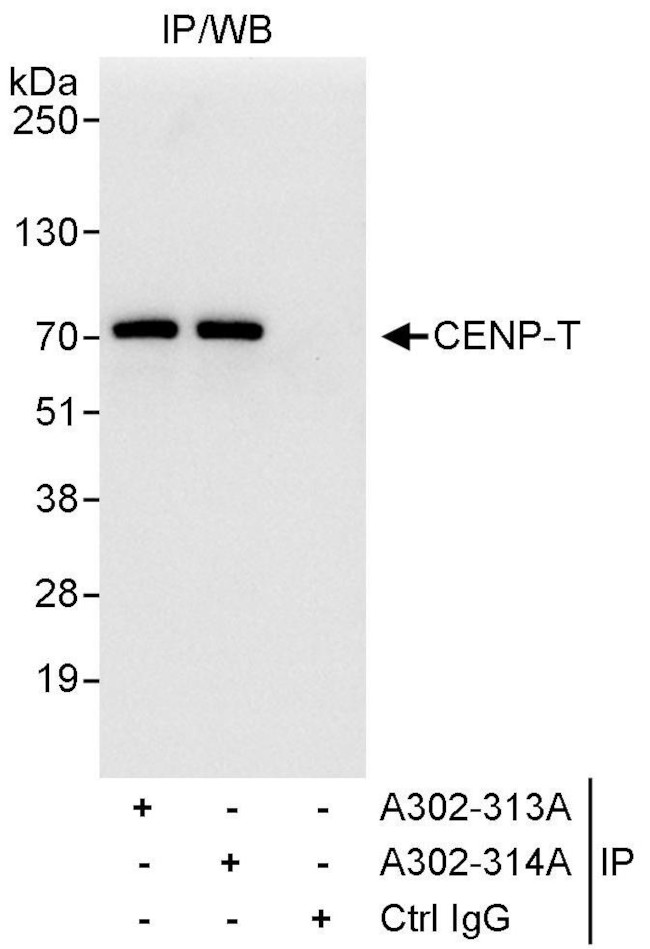 CENP-T Antibody in Immunoprecipitation (IP)