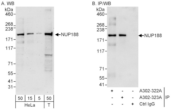 NUP188 Antibody in Western Blot (WB)
