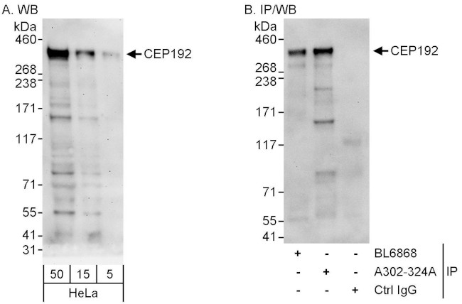 CEP192 Antibody in Western Blot (WB)