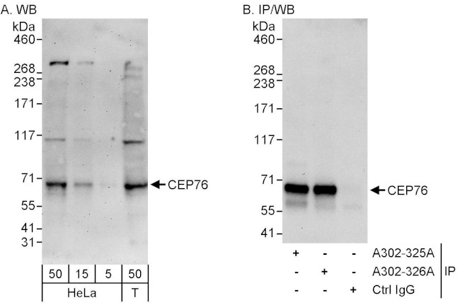 CEP76 Antibody in Western Blot (WB)