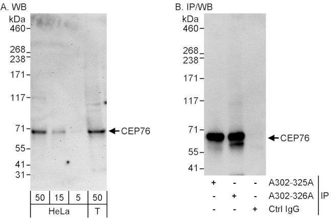 CEP76 Antibody in Western Blot (WB)