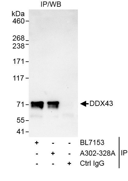 DDX43 Antibody in Immunoprecipitation (IP)