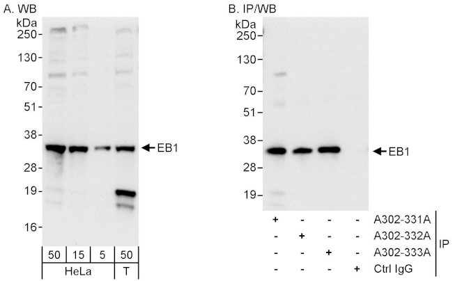 EB1 Antibody in Western Blot (WB)