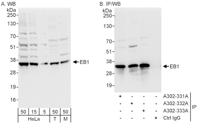EB1 Antibody in Western Blot (WB)