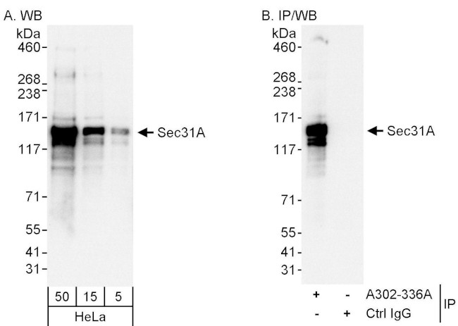 Sec31A Antibody in Western Blot (WB)