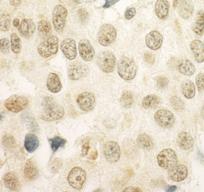 PRCC Antibody in Immunohistochemistry (Paraffin) (IHC (P))