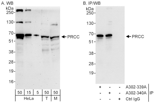PRCC Antibody in Western Blot (WB)