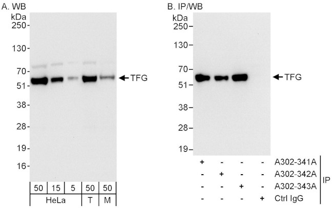 TFG Antibody in Western Blot (WB)