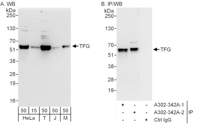 TFG Antibody in Western Blot (WB)