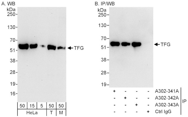 TFG Antibody in Western Blot (WB)