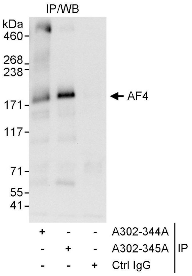 AF4 Antibody in Immunoprecipitation (IP)