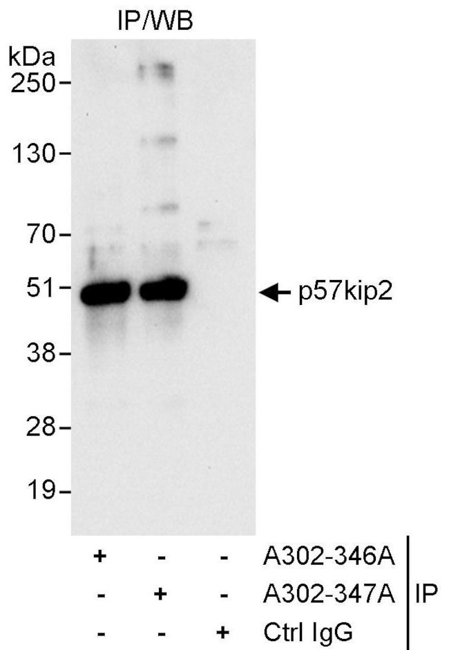 p57kip2 Antibody in Immunoprecipitation (IP)