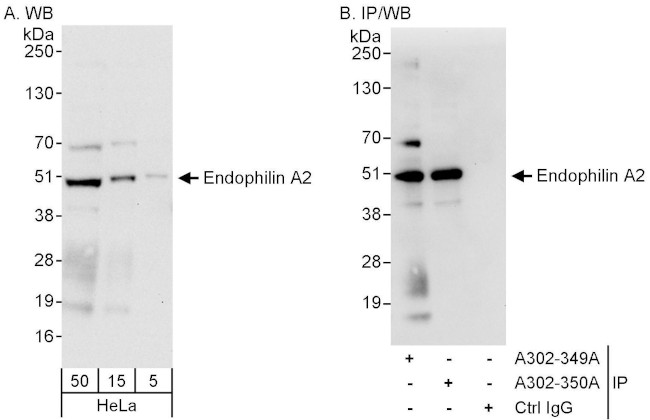 Endophilin A2 Antibody in Western Blot (WB)