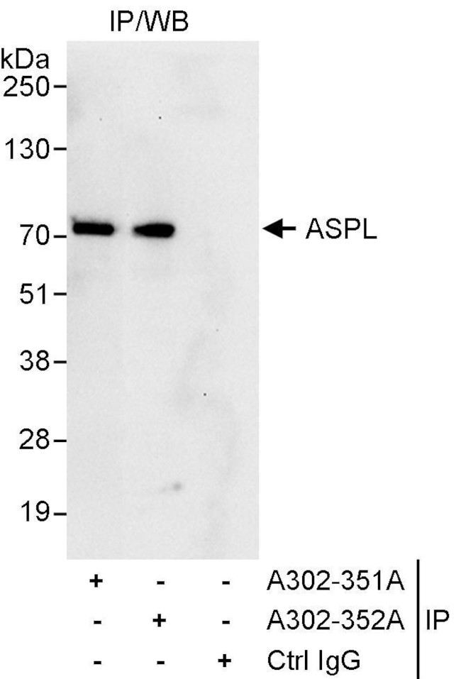 ASPL Antibody in Immunoprecipitation (IP)
