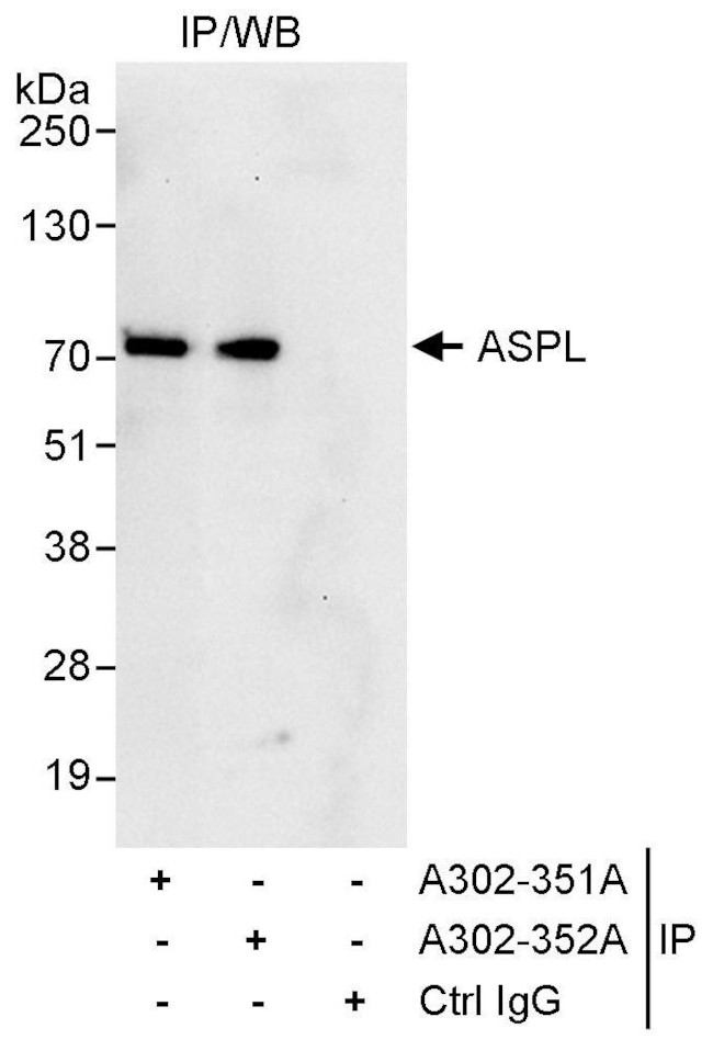 ASPL Antibody in Immunoprecipitation (IP)