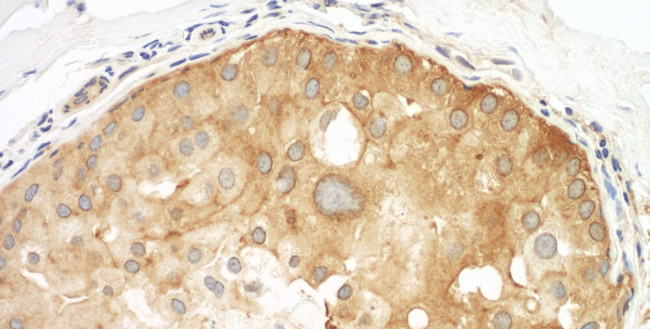 Septin 9 Antibody in Immunohistochemistry (Paraffin) (IHC (P))