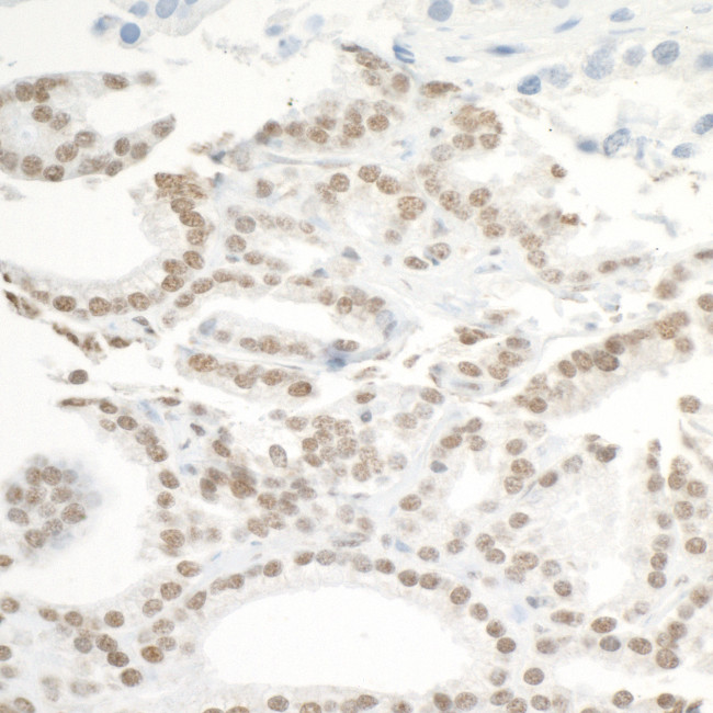 BRD3 Antibody in Immunohistochemistry (Paraffin) (IHC (P))