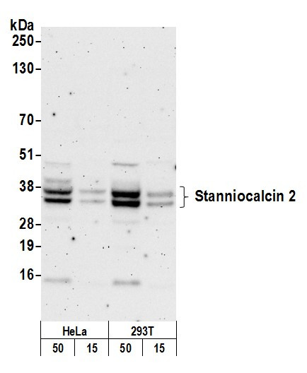 Stanniocalcin 2 Antibody in Western Blot (WB)