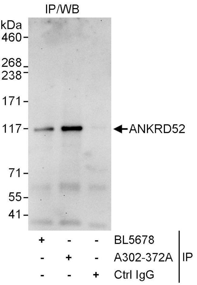 ANKRD52 Antibody in Immunoprecipitation (IP)