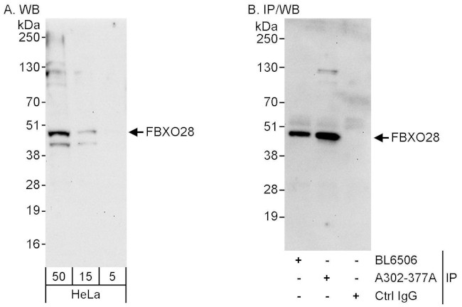 FBXO28 Antibody in Western Blot (WB)