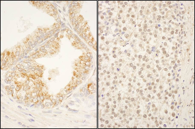 FBXO38 Antibody in Immunohistochemistry (Paraffin) (IHC (P))