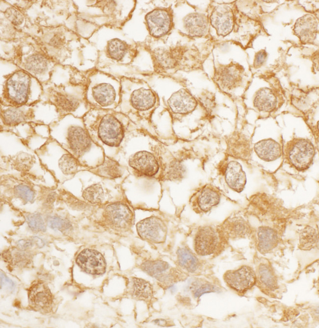 BORG4 Antibody in Immunohistochemistry (Paraffin) (IHC (P))