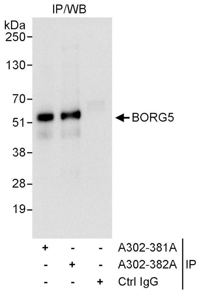 BORG5 Antibody in Immunoprecipitation (IP)