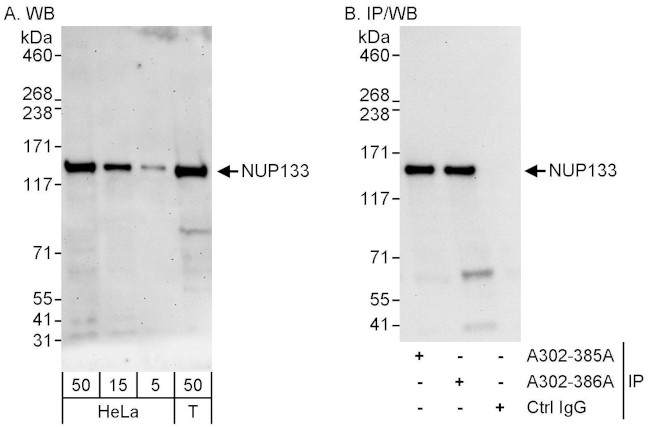 NUP133 Antibody in Western Blot (WB)
