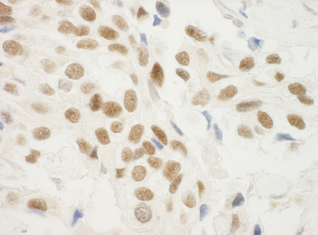 ZNF768 Antibody in Immunohistochemistry (Paraffin) (IHC (P))