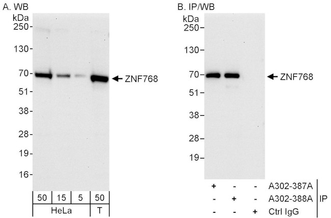 ZNF768 Antibody in Western Blot (WB)