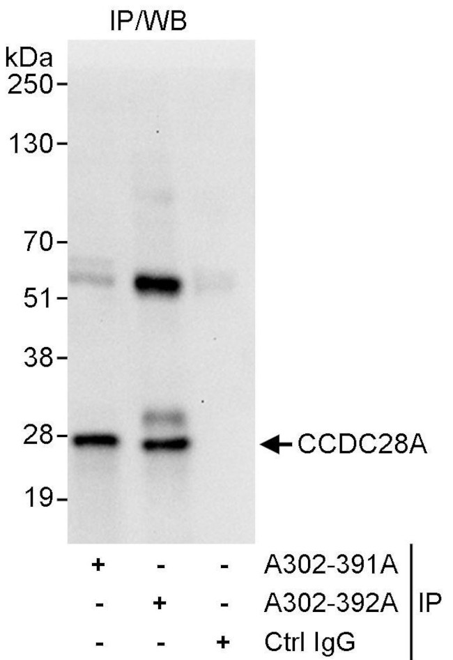 CCDC28A Antibody in Immunoprecipitation (IP)
