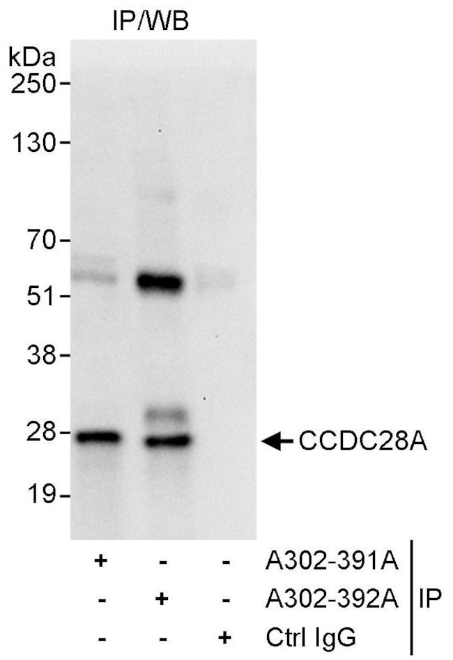 CCDC28A Antibody in Immunoprecipitation (IP)