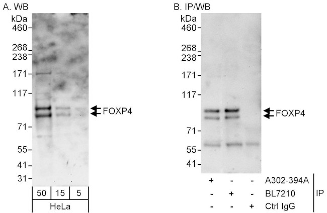 FOXP4 Antibody in Western Blot (WB)