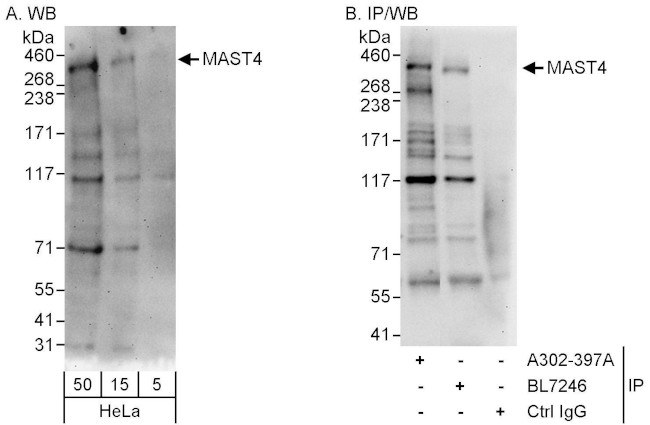 MAST4 Antibody in Western Blot (WB)