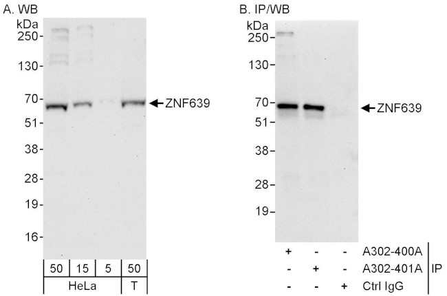 ZNF639 Antibody in Western Blot (WB)