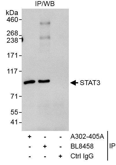 STAT3 Antibody in Immunoprecipitation (IP)