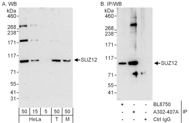 SUZ12 Antibody in Western Blot (WB)