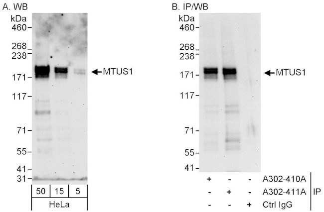 MTUS1 Antibody in Western Blot (WB)