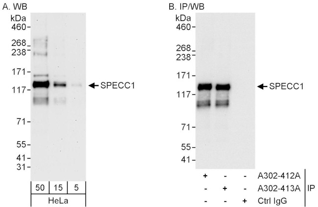 SPECC1 Antibody in Western Blot (WB)