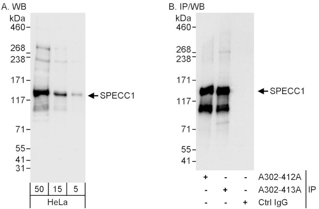 SPECC1 Antibody in Western Blot (WB)