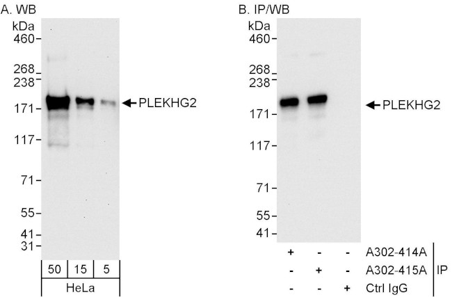PLEKHG2 Antibody in Western Blot (WB)