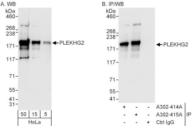 PLEKHG2 Antibody in Western Blot (WB)