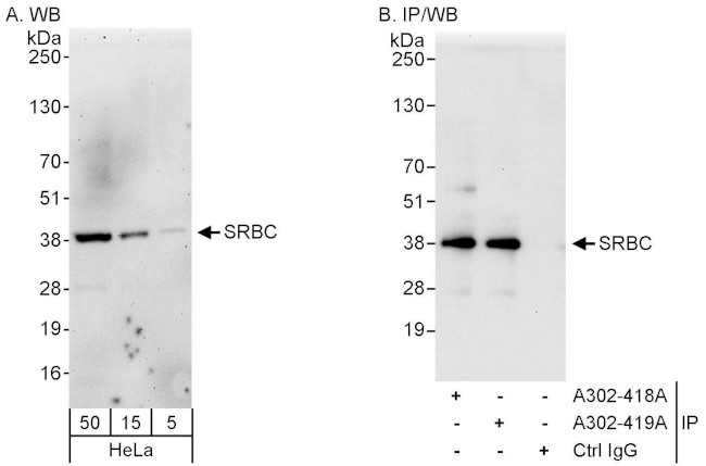 SRBC Antibody in Western Blot (WB)