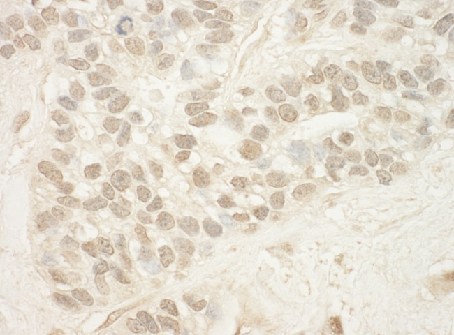 MED15 Antibody in Immunohistochemistry (Paraffin) (IHC (P))