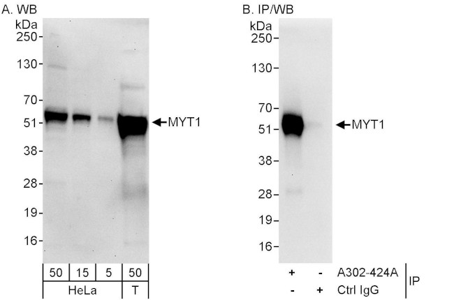 MYT1 Antibody in Western Blot (WB)