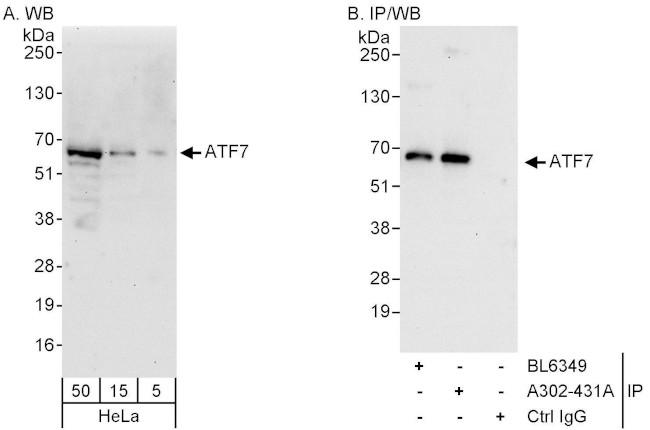 ATF7 Antibody in Western Blot (WB)