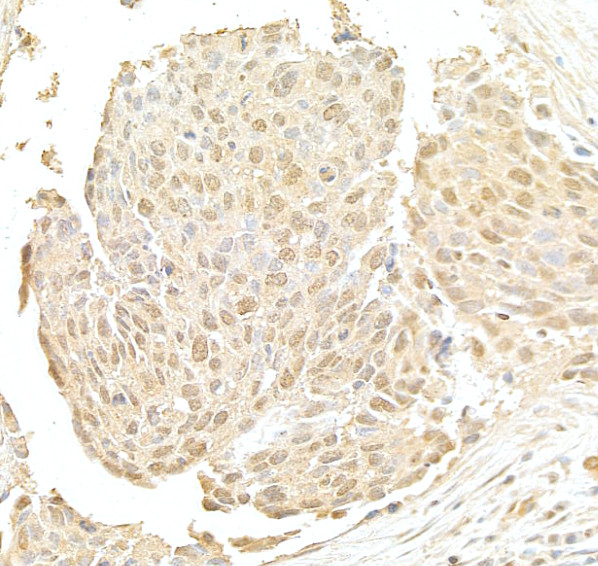 NRIP Antibody in Immunohistochemistry (Paraffin) (IHC (P))