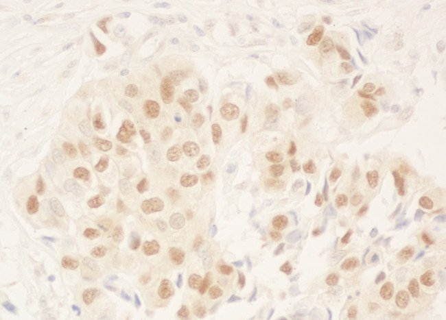 NRIP Antibody in Immunohistochemistry (Paraffin) (IHC (P))
