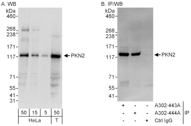 PKN2 Antibody in Western Blot (WB)