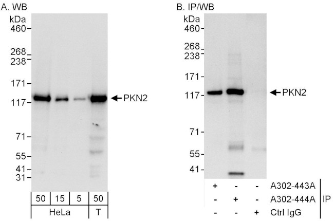 PKN2 Antibody in Western Blot (WB)